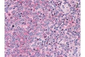 Immunohistochemistry (IHC) image for anti-ADAM Metallopeptidase Domain 17 (ADAM17) (AA 215-315) antibody (ABIN614668) (ADAM17 抗体  (AA 215-315))