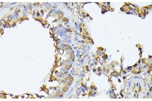 Immunohistochemistry of paraffin-embedded Rat lung using PSMB3 Polyclonal Antibody at dilution of 1:100 (40x lens). (PSMB3 抗体)
