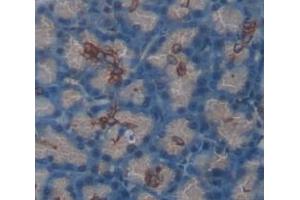 Immunohistochemistry (IHC) image for anti-Sema Domain, Immunoglobulin Domain (Ig), Transmembrane Domain (TM) and Short Cytoplasmic Domain, (Semaphorin) 4B (SEMA4B) (AA 644-832) antibody (ABIN1860523)