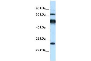 WB Suggested Anti-Klhl1 Antibody Titration: 1. (KLHL1 抗体  (C-Term))