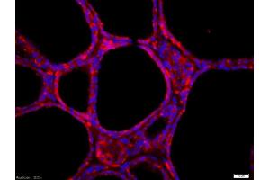 Tissue/cell: human thyroid gland, 4% Paraformaldehyde-fixed and paraffin-embeddedAntigen retrieval: citrate buffer (0. (GFRA4 抗体  (AA 51-150))