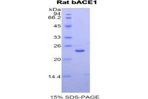 SDS-PAGE analysis of Rat bACE1 Protein. (BACE1 蛋白)