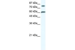 WB Suggested Anti-FLJ23436 Antibody Titration:  1. (ZNF768 抗体  (N-Term))