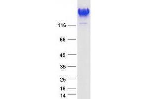 Validation with Western Blot