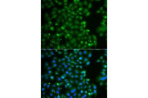 Immunofluorescence analysis of A549 cell using ANXA11 antibody. (Annexin A11 抗体)