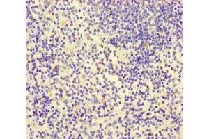 Immunohistochemistry of paraffin-embedded human spleen tissue using ABIN7156438 at dilution of 1:100 (ITGA4 抗体  (AA 376-558))