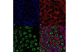 Immunohistochemistry (IHC) image for anti-Solute Carrier Family 12 (Sodium/potassium/chloride Transporters), Member 1 (SLC12A1) (AA 33-55) antibody (Atto 390) (ABIN2486316)