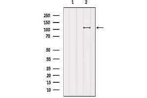 Western Blotting (WB) image for anti-BTB and CNC Homology 1, Basic Leucine Zipper Transcription Factor 1 (BACH1) (Internal Region) antibody (ABIN6260184)