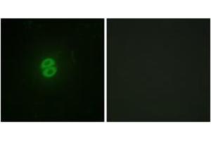 Immunofluorescence analysis of A549 cells, using CD253 Antibody. (TRAIL 抗体  (AA 31-80))