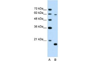 WB Suggested Anti-SLC38A4 Antibody Titration:  2. (SLC38A4 抗体  (Middle Region))