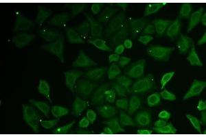 Immunofluorescence analysis of U2OS cells using C21orf33 Polyclonal Antibody (C21orf33 抗体)