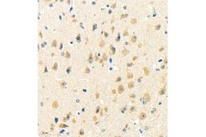 Immunohistochemistry of paraffin embedded mouse brain using rasgrf1 (ABIN7073422) at dilution of 1:4000 (400x lens) (Cdc25 抗体)