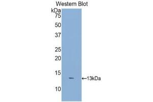Detection of Recombinant DKK2, Human using Polyclonal Antibody to Dickkopf Related Protein 2 (DKK2) (DKK2 抗体  (AA 159-258))