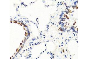 Immunohistochemistry of paraffin-embedded Rat lung using NTF3 Polyclonal Antibody at dilution of 1:100 (40x lens). (Neurotrophin 3 抗体)