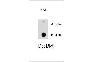 Dot blot analysis of anti-Phospho-MEK1 Pab (ABIN389590 and ABIN2839607) on nitrocellulose membrane. (MEK1 抗体  (pSer218, pSer222))