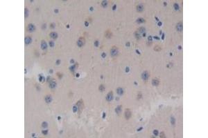 Used in DAB staining on fromalin fixed paraffin- embedded Kidney tissue (Neurocan 抗体  (AA 960-1225))