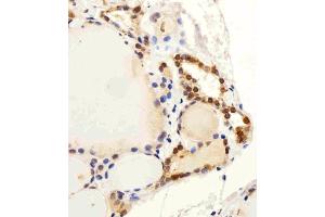 Immunohistochemical analysis of paraffin-embedded H. (C13orf30 抗体  (C-Term))
