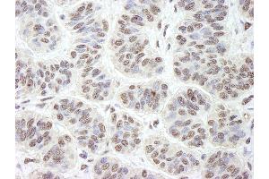 Immunohistochemistry (IHC) image for anti-Guanine Nucleotide Binding Protein-Like 3 (Nucleolar) (GNL3) (C-Term) antibody (ABIN7448582)