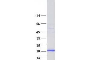 Western Blotting (WB) image for Golgin A7 (GOLGA7) (Transcript Variant 3) protein (Myc-DYKDDDDK Tag) (ABIN2722122)