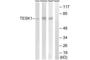 Western blot analysis of extracts from rat heart cells, rat kidney cells and rat liver cells, using TESK1 antibody. (TESK1 抗体)