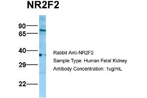 Host:  Rabbit  Target Name:  NR2F2  Sample Type:  Human Fetal Kidney  Antibody Dilution:  1. (NR2F2 抗体  (N-Term))
