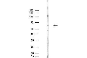 Western blot analysis of lysates from HUVEC cells(UV,30 min treatment), using Phospho-Estrogen Receptor alpha (Tyr537) Antibody at 1/1000 dilution.