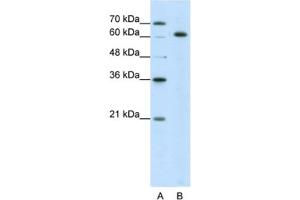 Western Blotting (WB) image for anti-Small Nuclear Ribonucleoprotein 70kDa (U1) (SNRNP70) antibody (ABIN2462077) (SNRNP70 抗体)