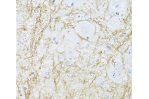 Immunohistochemistry of paraffin-embedded Mouse spinal cord using CNP Polyclonal Antibody at dilution of 1:100 (40x lens). (Cnpase 抗体)