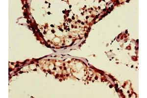 Immunohistochemistry of paraffin-embedded human testis tissue using ABIN7174147 at dilution of 1:100 (ZRSR2 抗体  (AA 191-372))