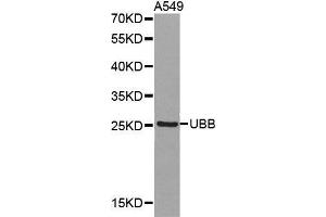 Western blot analysis of extracts of A549 cell lines, using UBB antibody. (Ubiquitin B 抗体  (AA 1-76))