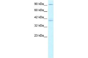 KIFC2 antibody used at 1. (KIFC2 抗体  (N-Term))