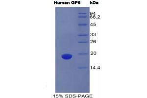 SDS-PAGE analysis of Human GP6 Protein. (GP6 蛋白)