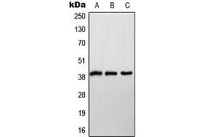 Western blot analysis of NDUFA9 expression in HeLa (A), SP2/0 (B), H9C2 (C) whole cell lysates. (NDUFA9 抗体  (Center))