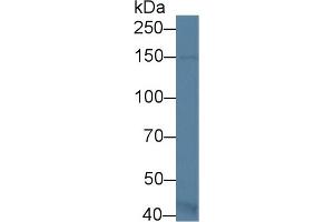 Western Blot; Sample: Mouse Kidney lysate; Primary Ab: 1µg/ml Rabbit Anti-Mouse ASK1 Antibody Second Ab: 0. (ASK1 抗体  (AA 693-933))