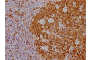 IHC image of ABIN7180562 diluted at 1:100 and staining in paraffin-embedded human tonsil tissue performed on a Leica BondTM system. (POU2AF1 抗体)