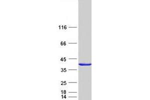 Western Blotting (WB) image for Cell Division Cycle 34 (CDC34) protein (Myc-DYKDDDDK Tag) (ABIN2713834)