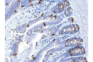 Immunohistochemistry (IHC) image for anti-Collagen, Type III, alpha 1 (COL3A1) (C-Term) antibody (ABIN2856819)