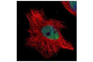 ICC/IF Image Confocal immunofluorescence analysis (Olympus FV10i) of paraformaldehyde-fixed HeLa, using WRN, antibody (Green) at 1:500 dilution. (RECQL2 抗体  (Center))