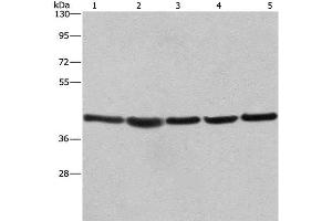Western Blot analysis of A549, NIH/3T3 and 293T cell,Human hepatocellular carcinoma tissue and hela cell using RPSA Polyclonal Antibody at dilution of 1:433. (RPSA/Laminin Receptor 抗体)