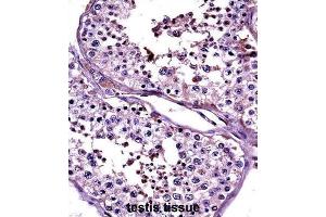 Immunohistochemistry (IHC) image for anti-Cancer/testis Antigen 2 (CTAG2) antibody (ABIN2997526) (CTAG2 抗体)