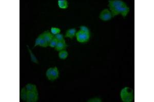 Immunofluorescence staining of MCF-7 cells with ABIN7155039 at 1:200, counter-stained with DAPI. (HEPACAM 抗体  (AA 265-415))