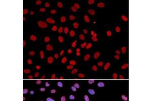 Immunofluorescence analysis of U2OS cells using PTPN6 Polyclonal Antibody (SHP1 抗体)