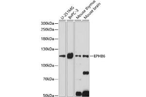 Western blot analysis of extracts of various cell lines, using EPHB6 antibody (ABIN7266973) at 1:1000 dilution. (EPH Receptor B6 抗体  (AA 615-729))