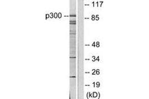 Western blot analysis of extracts from COLO205 cells, using p300/CBP Antibody. (KAT2B 抗体  (AA 783-832))