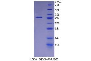 SDS-PAGE (SDS) image for Laminin, alpha 5 (LAMA5) (AA 3517-3718) protein (His tag) (ABIN1879746) (Laminin alpha 5 Protein (AA 3517-3718) (His tag))