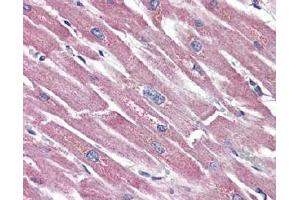 Heart, Human: Formalin-Fixed Paraffin-Embedded (FFPE) using Somatostatin Receptor 5 antibody. (SSTR5 抗体  (2nd Extracellular Domain))