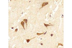 IHC analysis of FFPE human brain section using OTX2 antibody; Ab was diluted at 1:25. (OTX2 抗体  (C-Term))