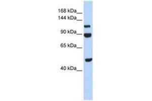 NARG1L 抗体  (AA 684-733)