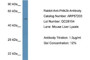 Western Blotting (WB) image for anti-Phosphatidylinositol 4-Kinase Type 2 beta (PI4K2B) (N-Term) antibody (ABIN785873) (PI4K2B 抗体  (N-Term))