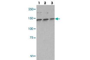Western blot analysis of lane 1: A549 cell lysate, lane 2: H460 cell lysate and lane 3: H1703 cell lysate using IARS polyclonal antibody . (IARS 抗体)